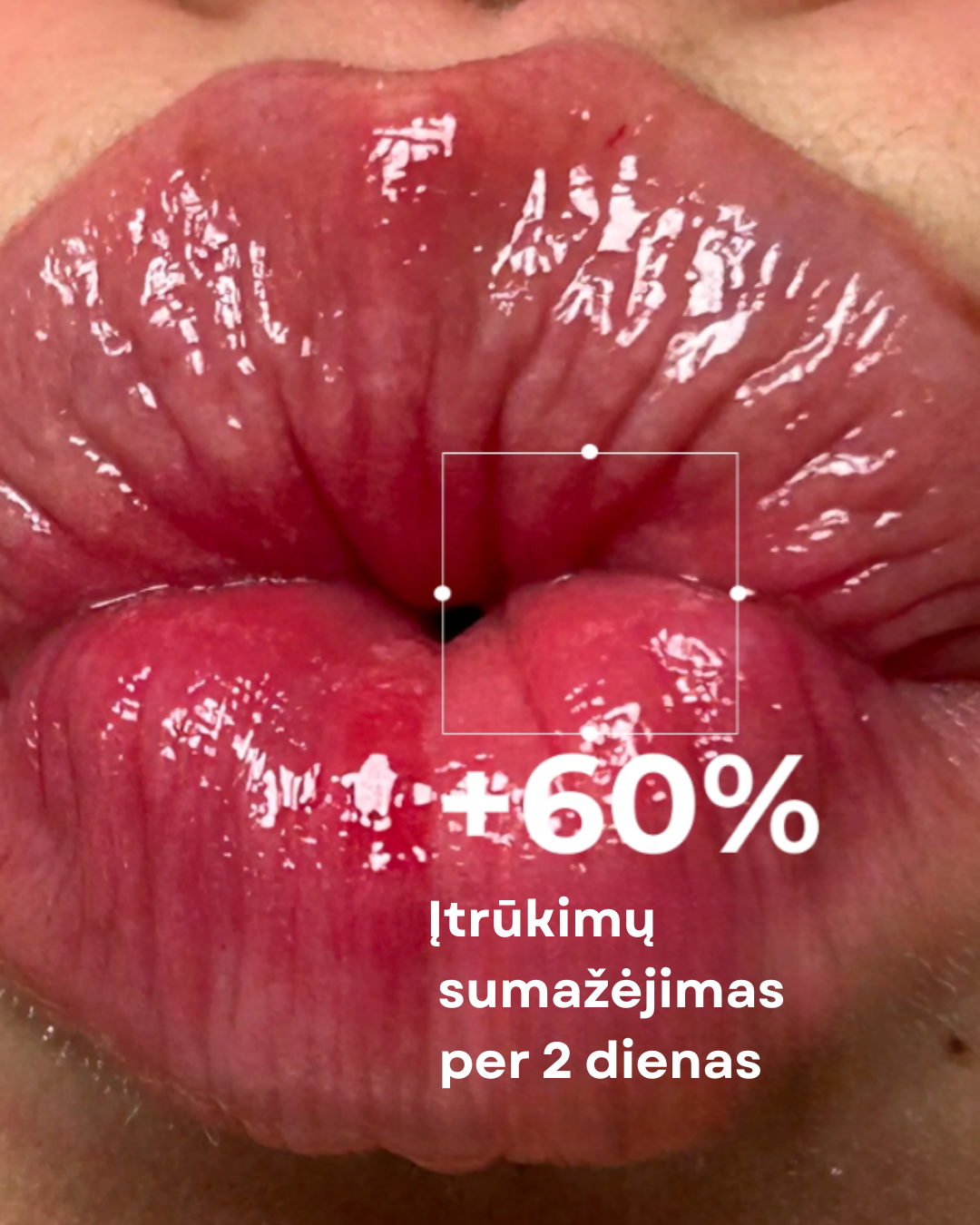 Lūpų balzamas „Ultra Repair“ su centelės ir persikų ekstraktu, 10 ml